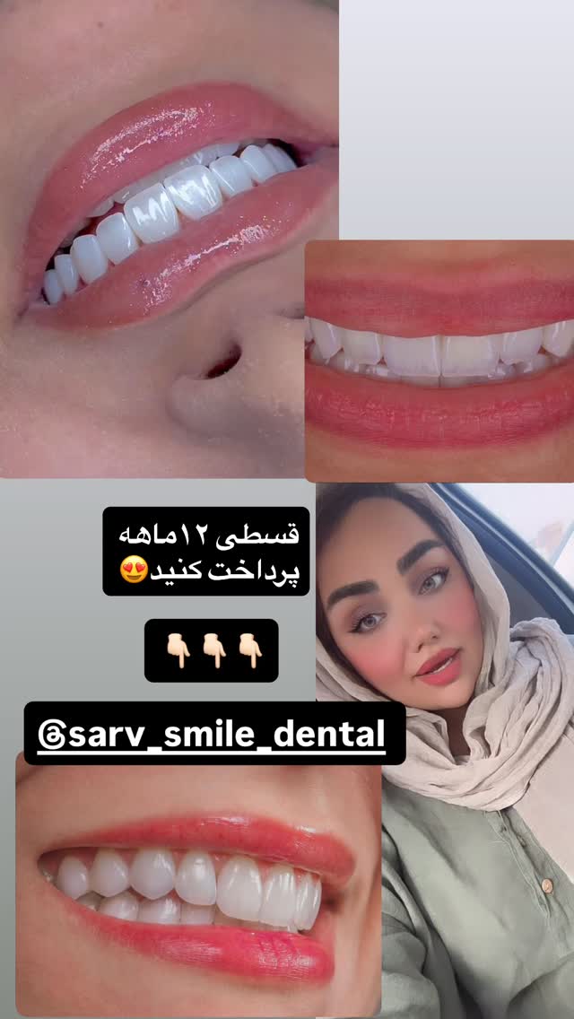  جدید ترین استوری اینستاگرام زهرا تاجیک