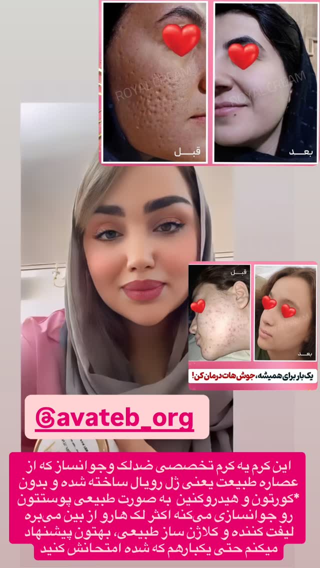  جدید ترین استوری اینستاگرام زهرا تاجیک