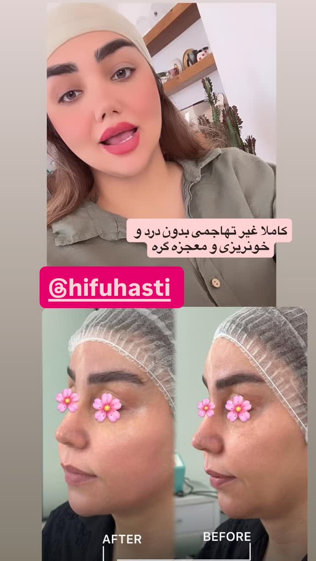  جدید ترین استوری اینستاگرام زهرا تاجیک