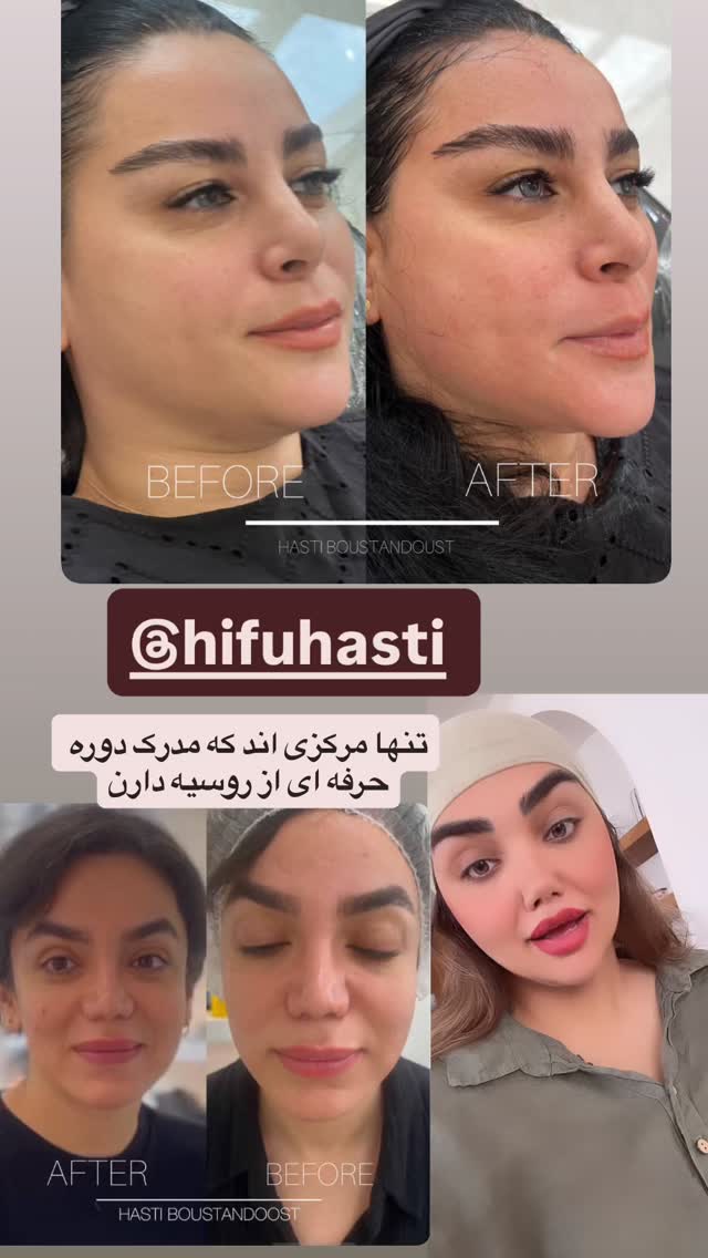  جدید ترین استوری اینستاگرام زهرا تاجیک