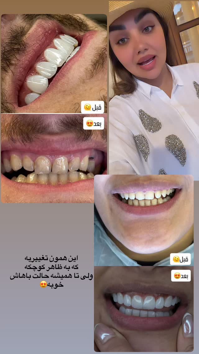  جدید ترین استوری اینستاگرام زهرا تاجیک