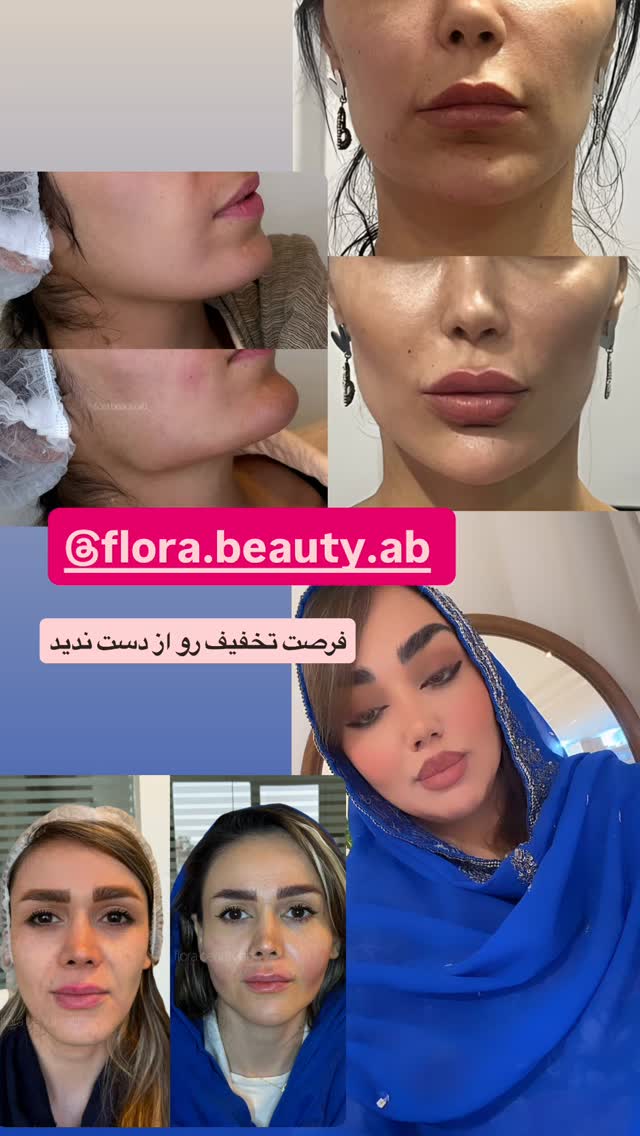 جدید ترین استوری اینستاگرام زهرا تاجیک