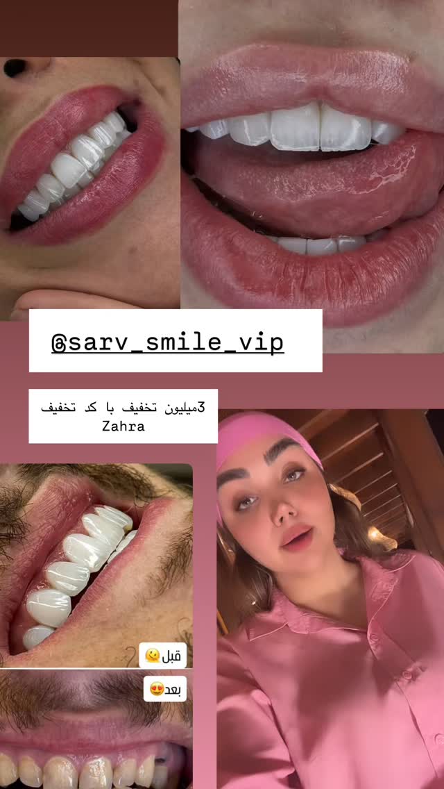  جدید ترین استوری اینستاگرام زهرا تاجیک