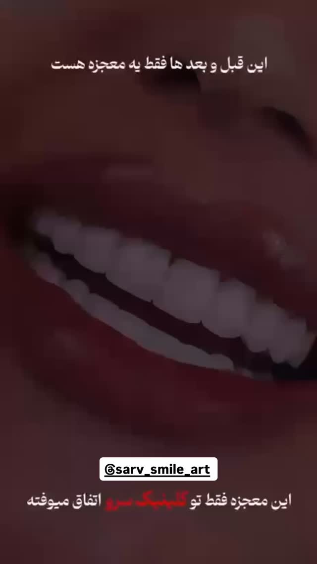  جدید ترین استوری اینستاگرام زهرا تاجیک