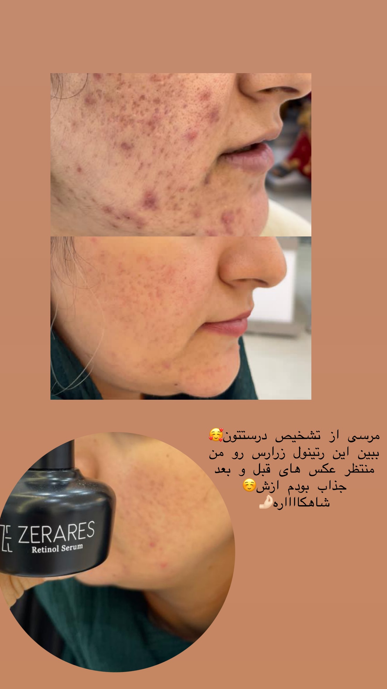  جدید ترین استوری اینستاگرام زهرا زائری