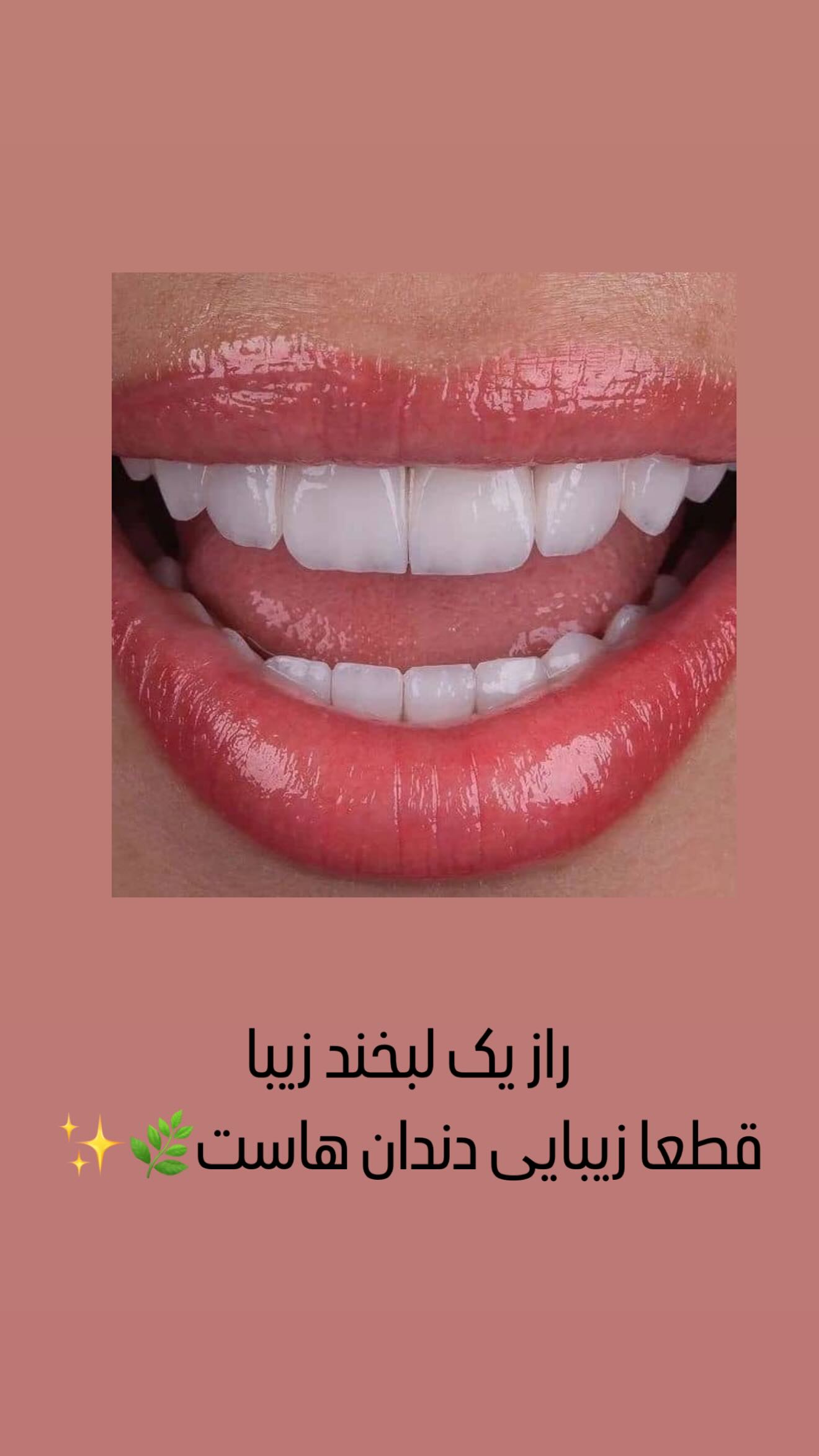  جدید ترین استوری اینستاگرام زهرا هرندی