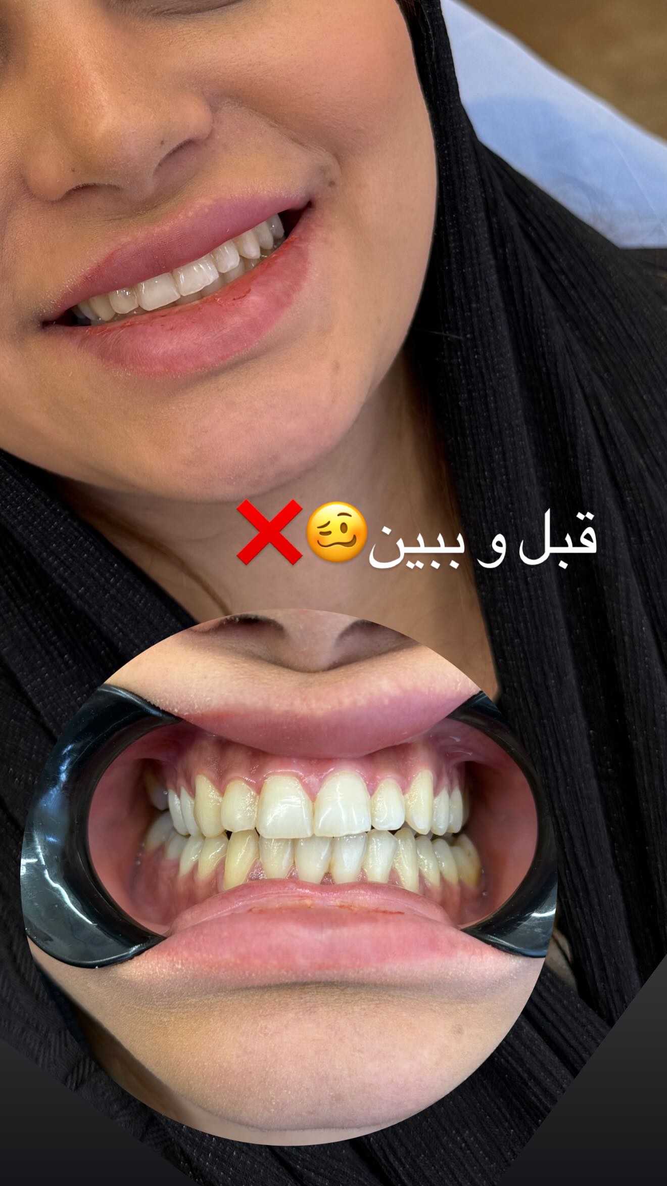  جدید ترین استوری اینستاگرام زهرا هرندی
