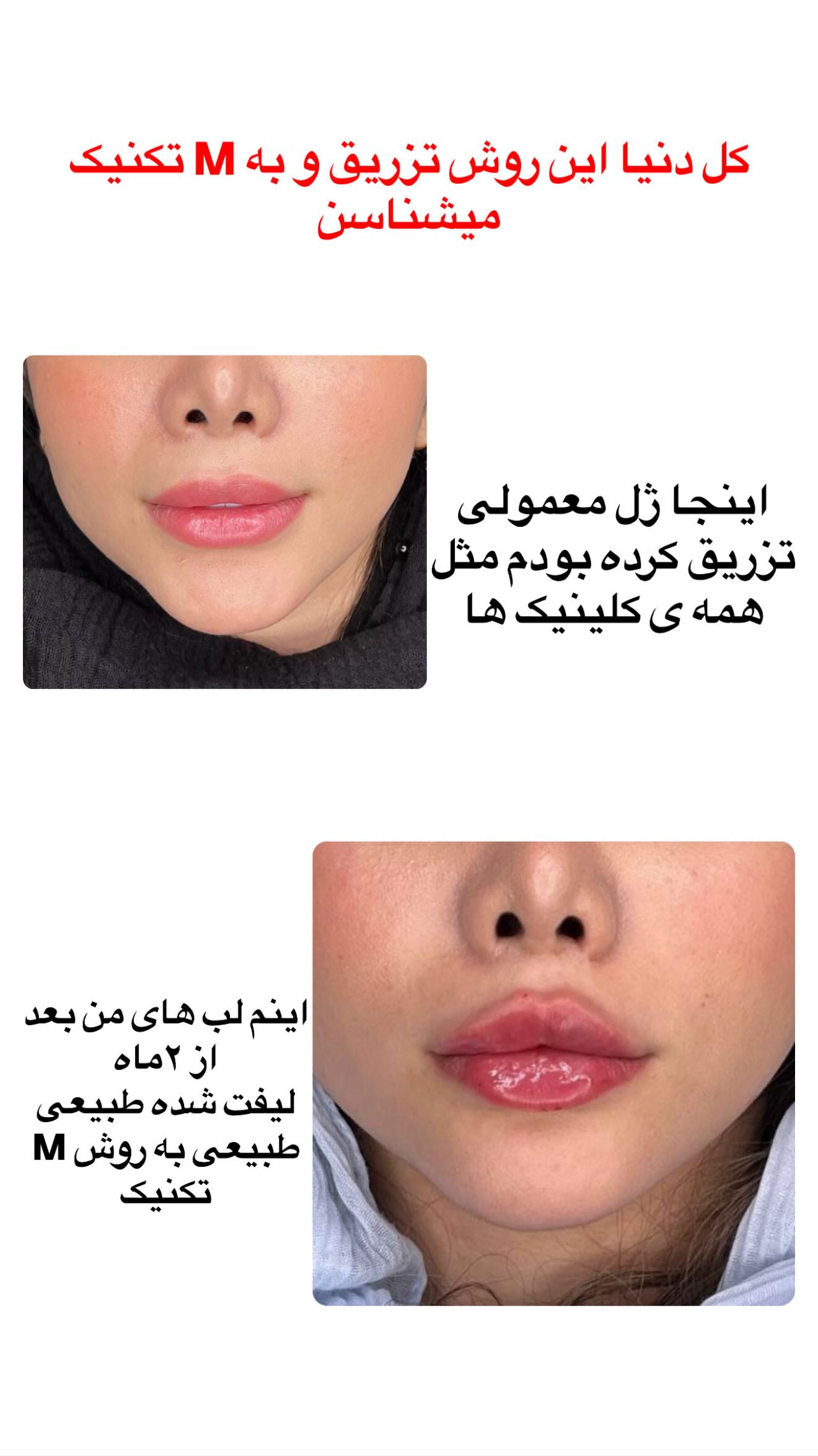  جدید ترین استوری اینستاگرام زهرا هرندی