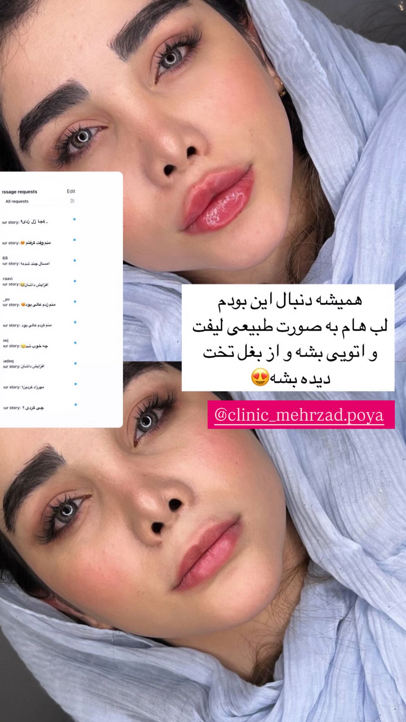  جدید ترین استوری اینستاگرام زهرا هرندی