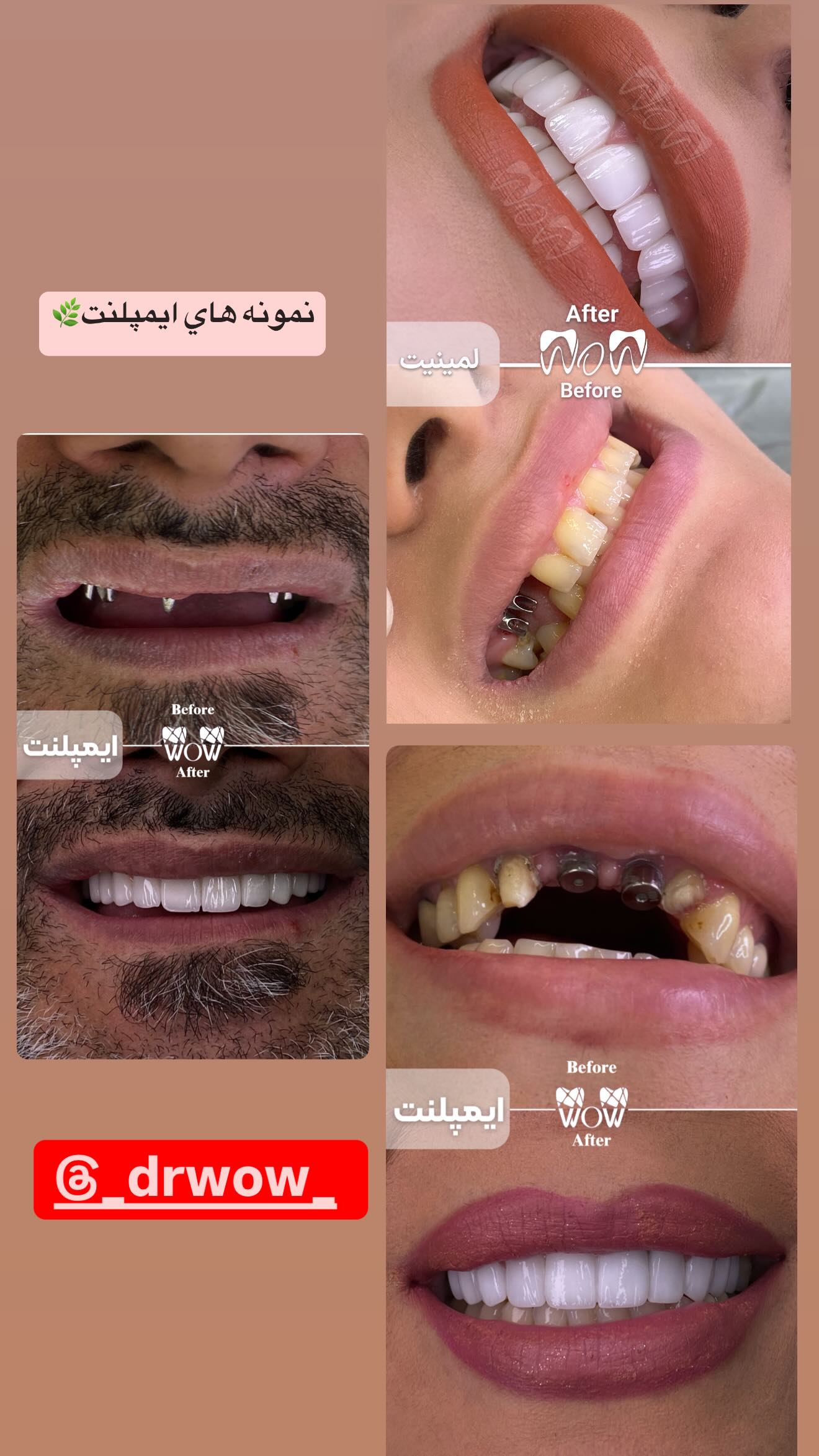  جدید ترین استوری اینستاگرام زهرا هرندی