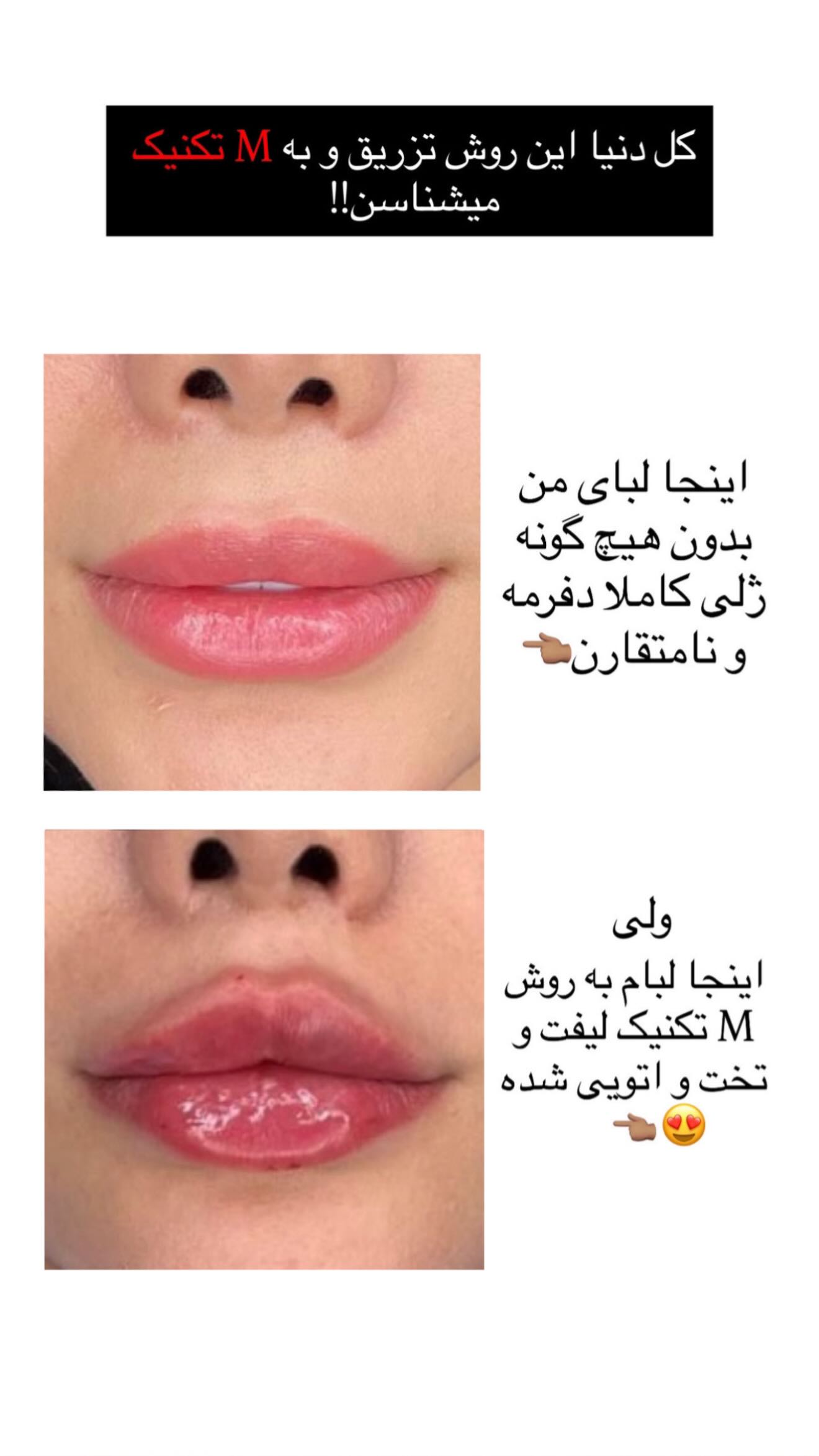  جدید ترین استوری اینستاگرام زهرا هرندی