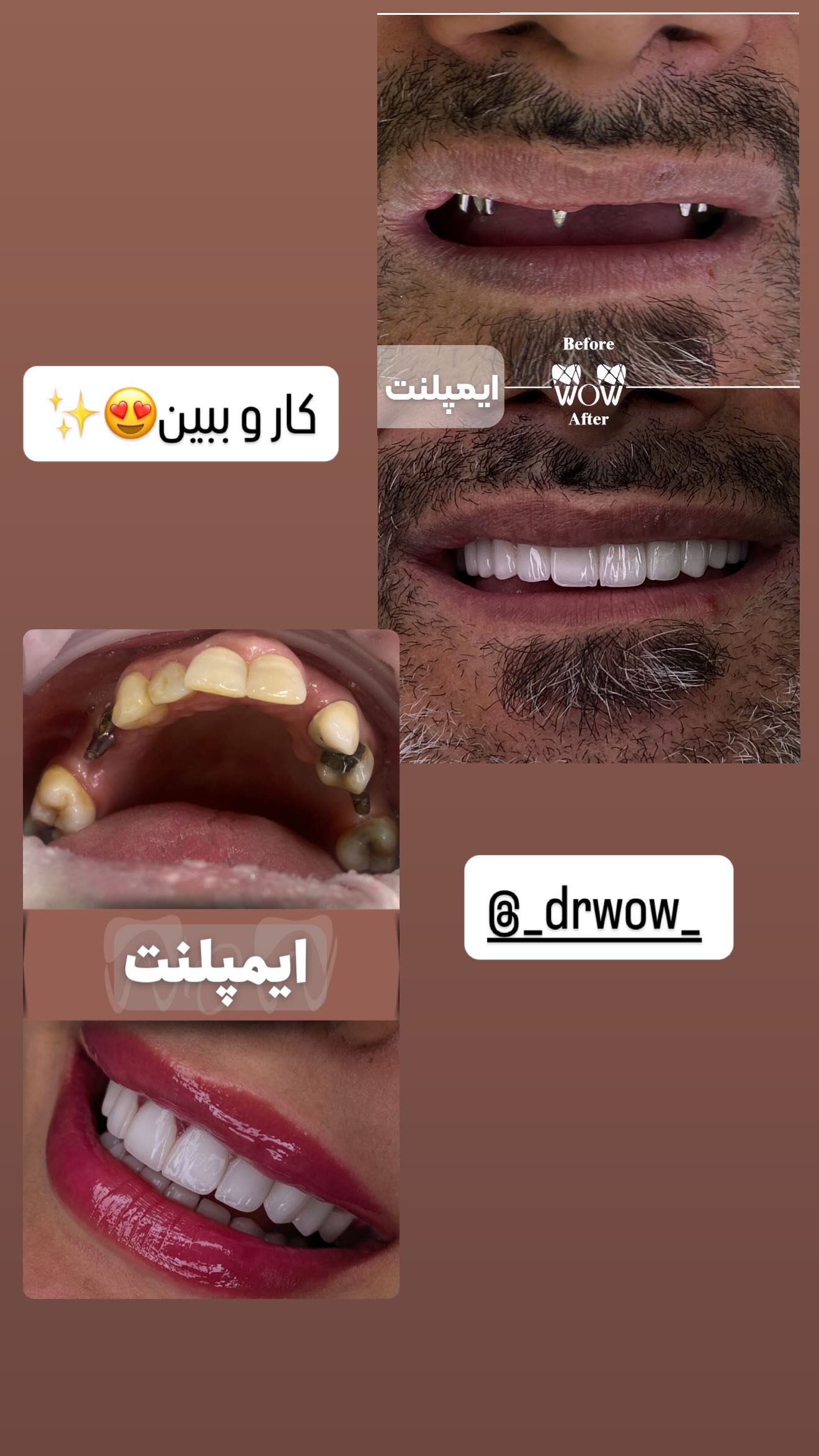  جدید ترین استوری اینستاگرام زهرا هرندی