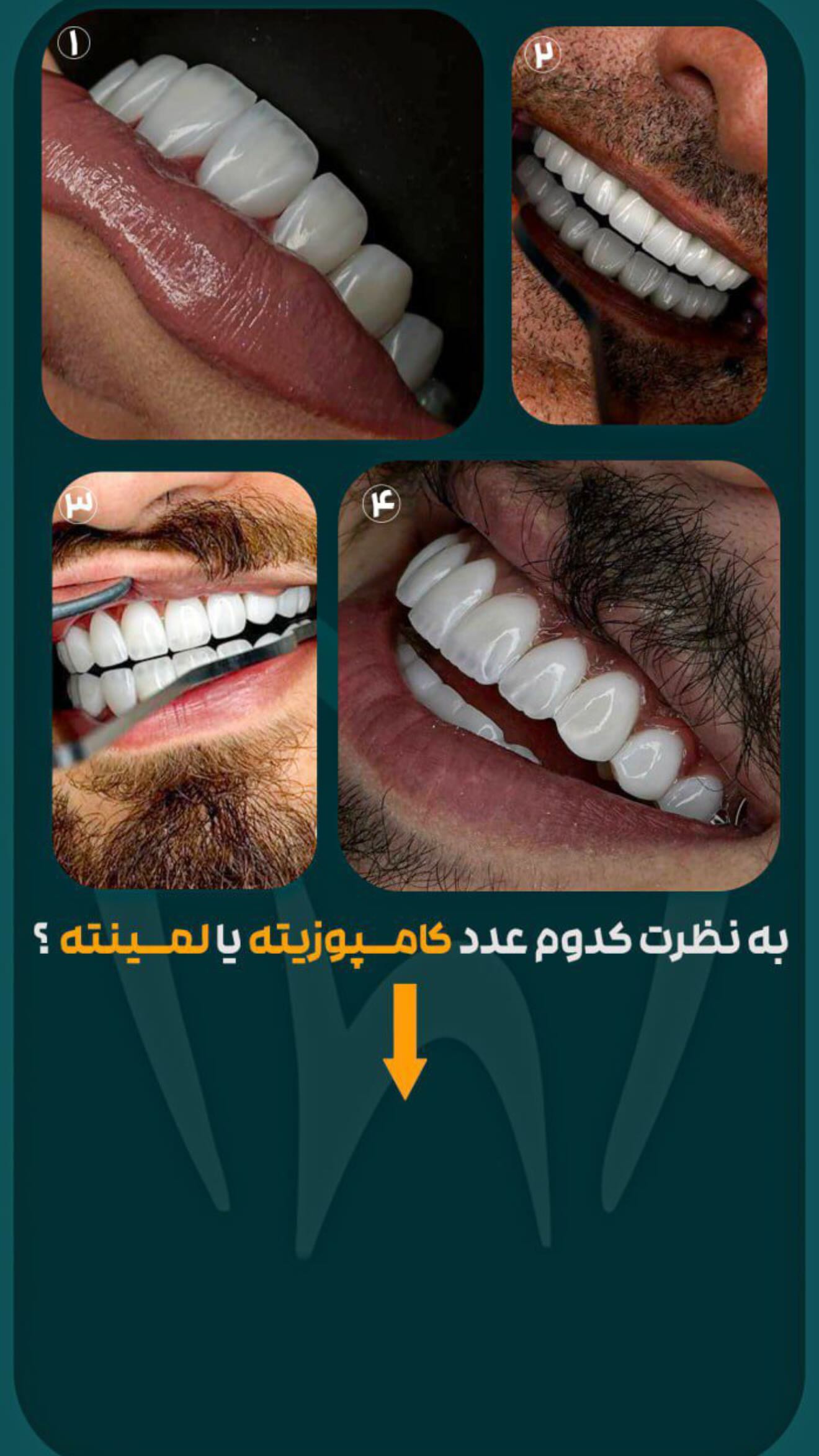  جدید ترین استوری اینستاگرام زهرا هرندی