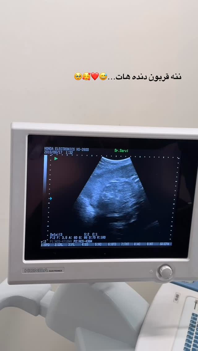  جدید ترین استوری اینستاگرام زهرا هرندی