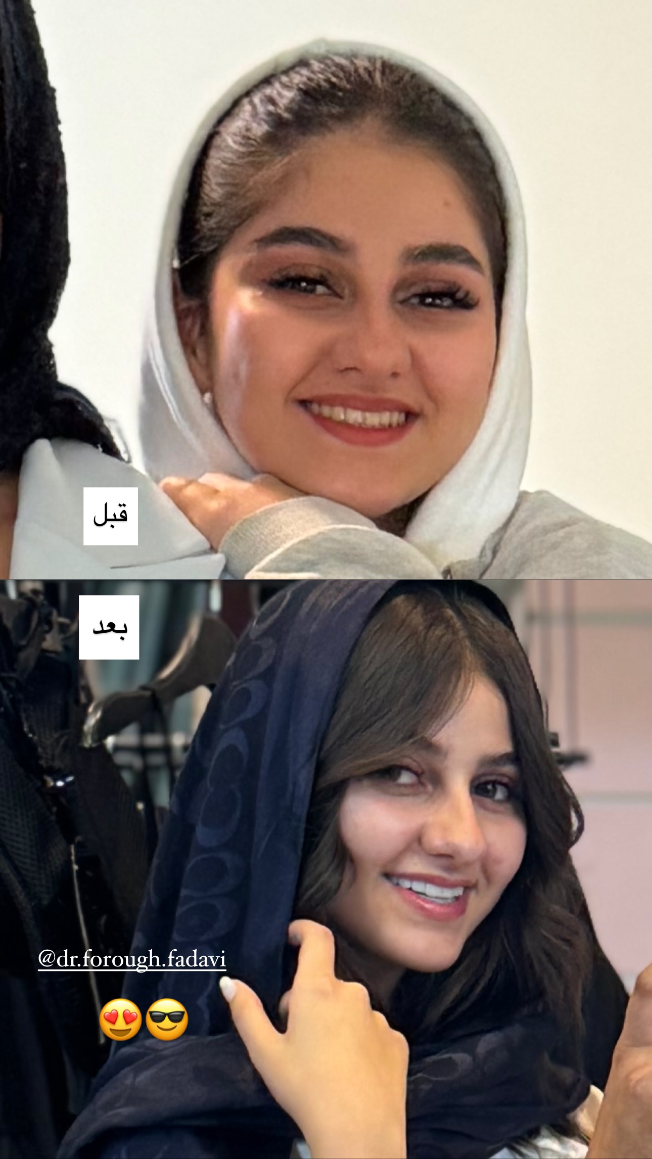  جدید ترین استوری اینستاگرام زهرا موسوی
