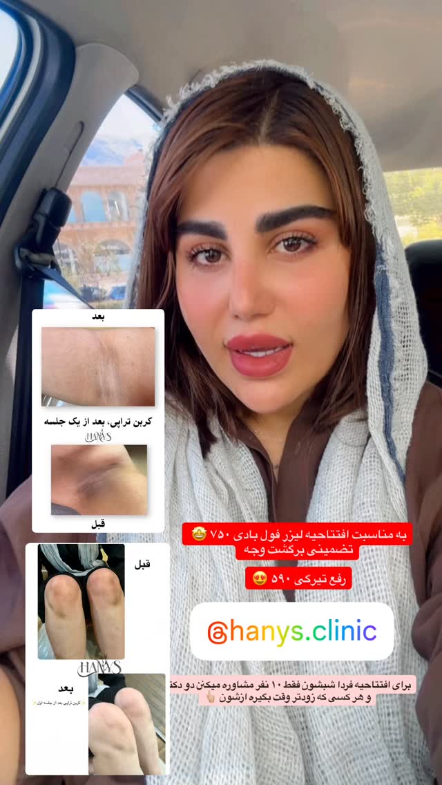  جدید ترین استوری اینستاگرام زهرا موسوی