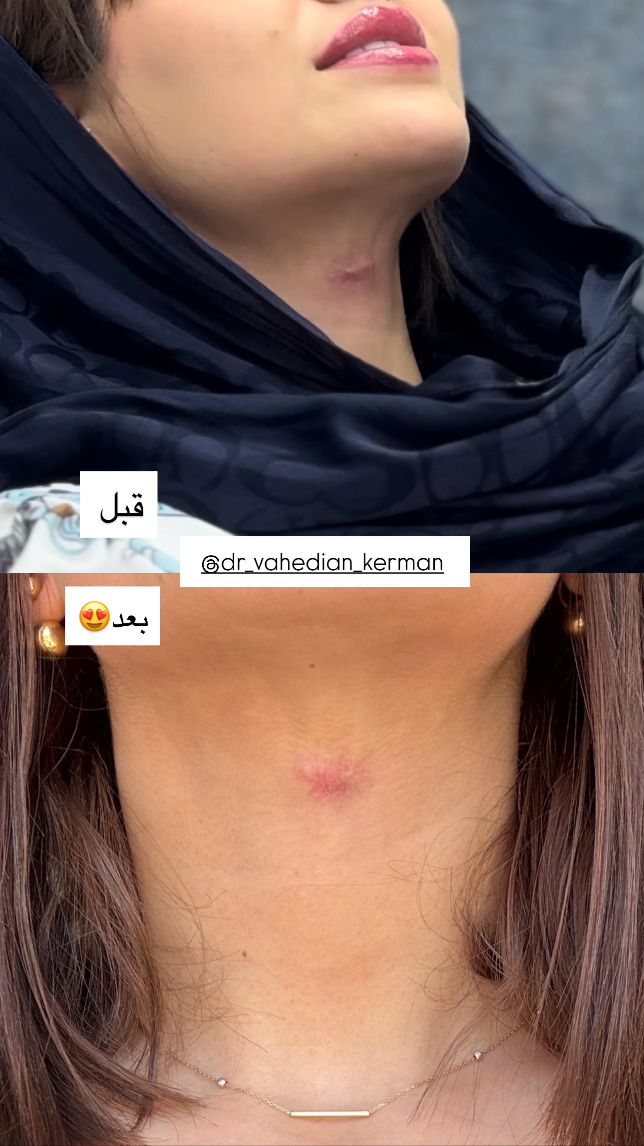  جدید ترین استوری اینستاگرام زهرا موسوی