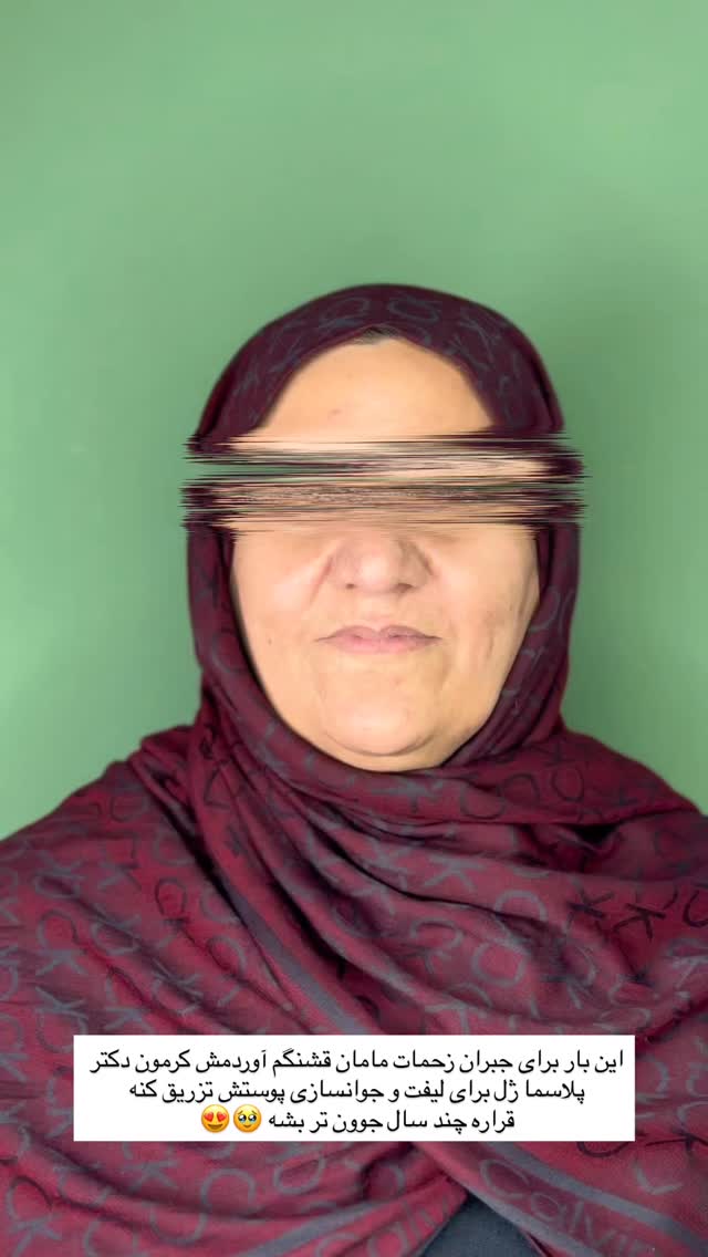  جدید ترین استوری اینستاگرام زهرا موسوی