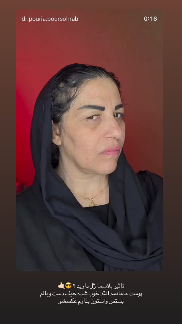  جدید ترین استوری اینستاگرام زهرا موسوی